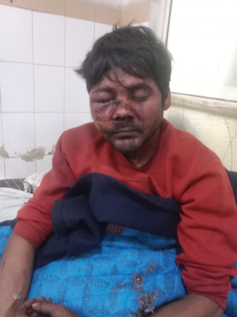 पुराने विवाद पर घर पर गाली गलौज करने आए युवक के साथ दो लोगों ने की मारपीट ,तोड़ दिए हाथ पैर पुराने विवाद पर घर पर गाली गलौज करने आए युवक के साथ दो लोगों ने की मारपीट ,तोड़ दिए हाथ पैर
