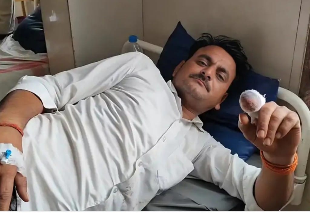 खराब नमकीन लौटाकर कहा चब नहीं रहा, दुकानदार ने गुस्से में ग्राहक की दांत से चबा दी अंगुली खराब नमकीन लौटाकर कहा चब नहीं रहा, दुकानदार ने गुस्से में ग्राहक की दांत से चबा दी अंगुली
